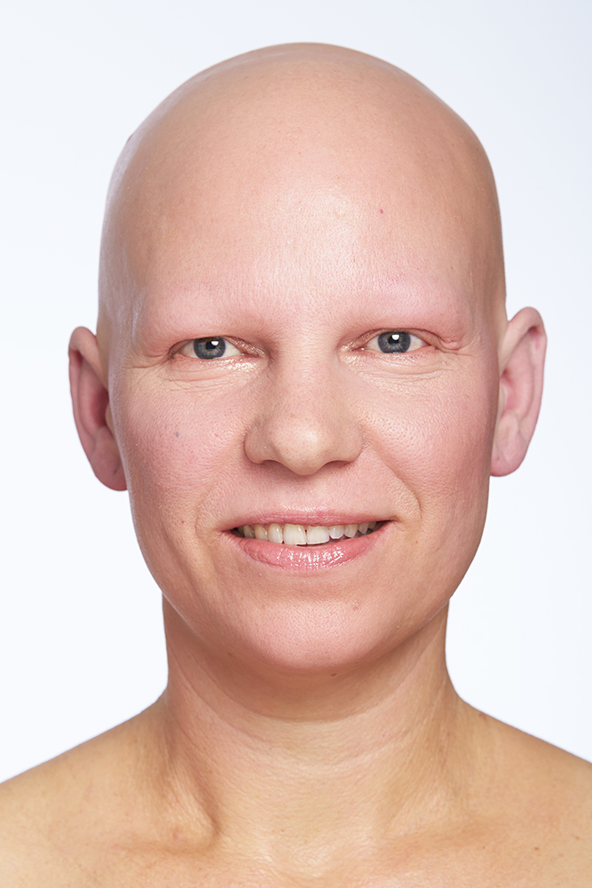 Micropigmentation Permanent Make-Up PMU Kundin Goldeneye Vorher